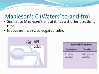 Mapleson's C (Waters’ to-and-fro)
• Similar to Mapleson's B, but it has a shorter breathing
tube.
• It does not have a corrugated tube.
 