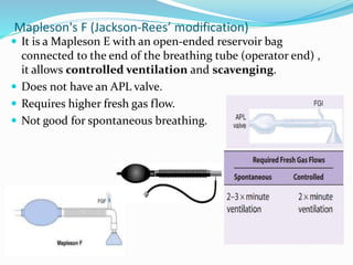 Mapleson's F (Jackson-Rees’ modification)
 It is a Mapleson E with an open-ended reservoir bag
connected to the end of the breathing tube (operator end) ,
it allows controlled ventilation and scavenging.
 Does not have an APL valve.
 Requires higher fresh gas flow.
 Not good for spontaneous breathing.
 