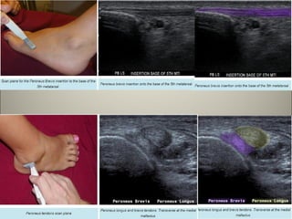 My ankle and foot MSK ultrasound (2).pdf