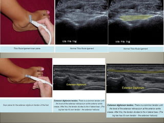 My ankle and foot MSK ultrasound (2).pdf