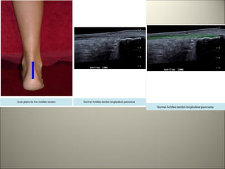 My ankle and foot MSK ultrasound (2).pdf