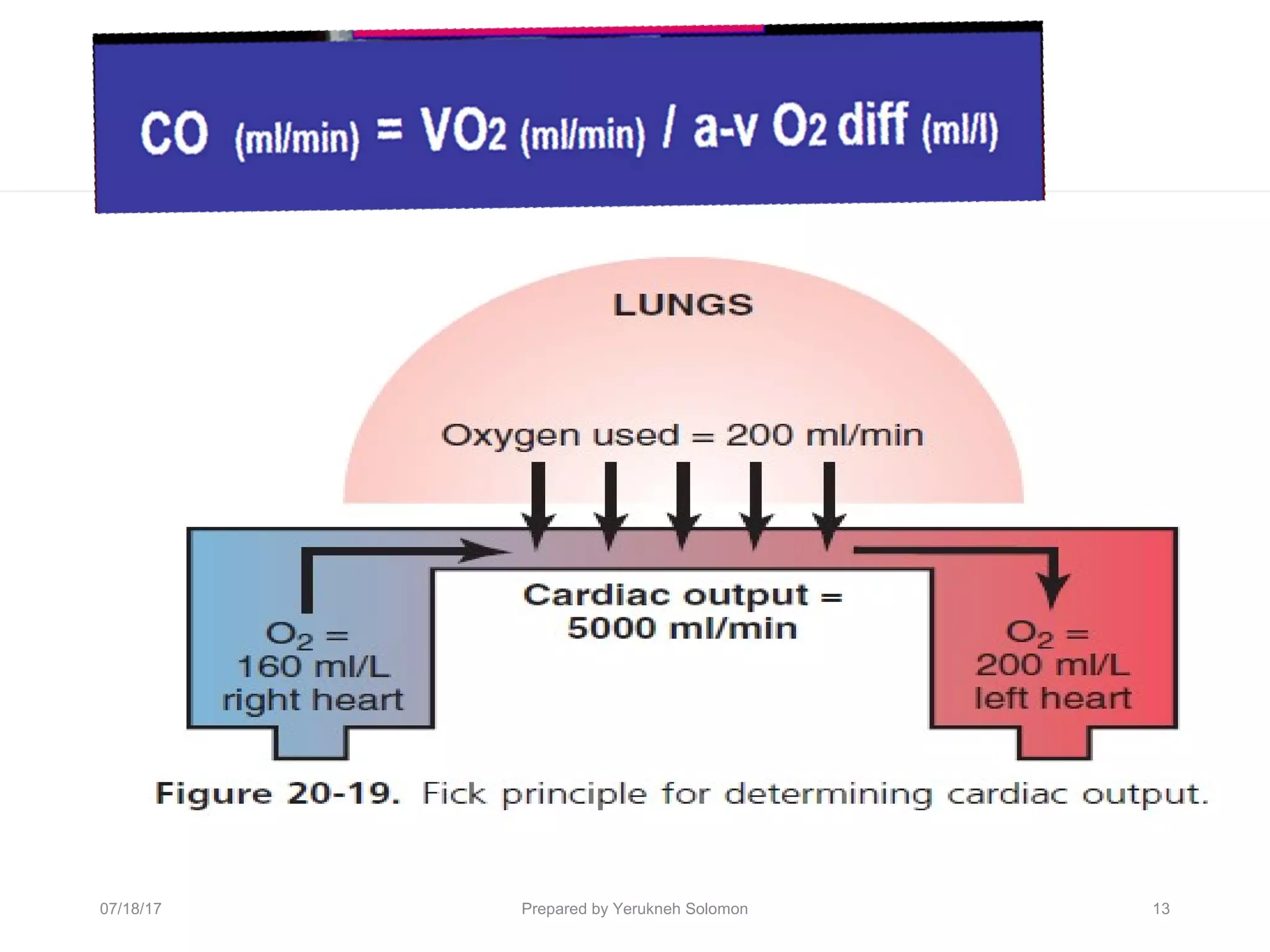 13Prepared by Yerukneh Solomon07/18/17
 