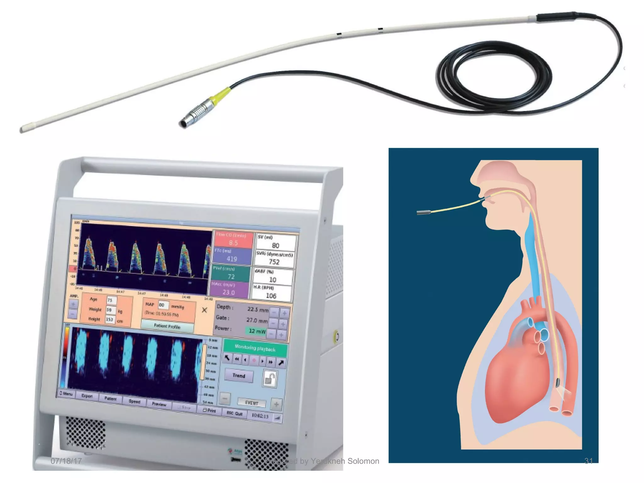 07/18/17 Prepared by Yerukneh Solomon 31
 