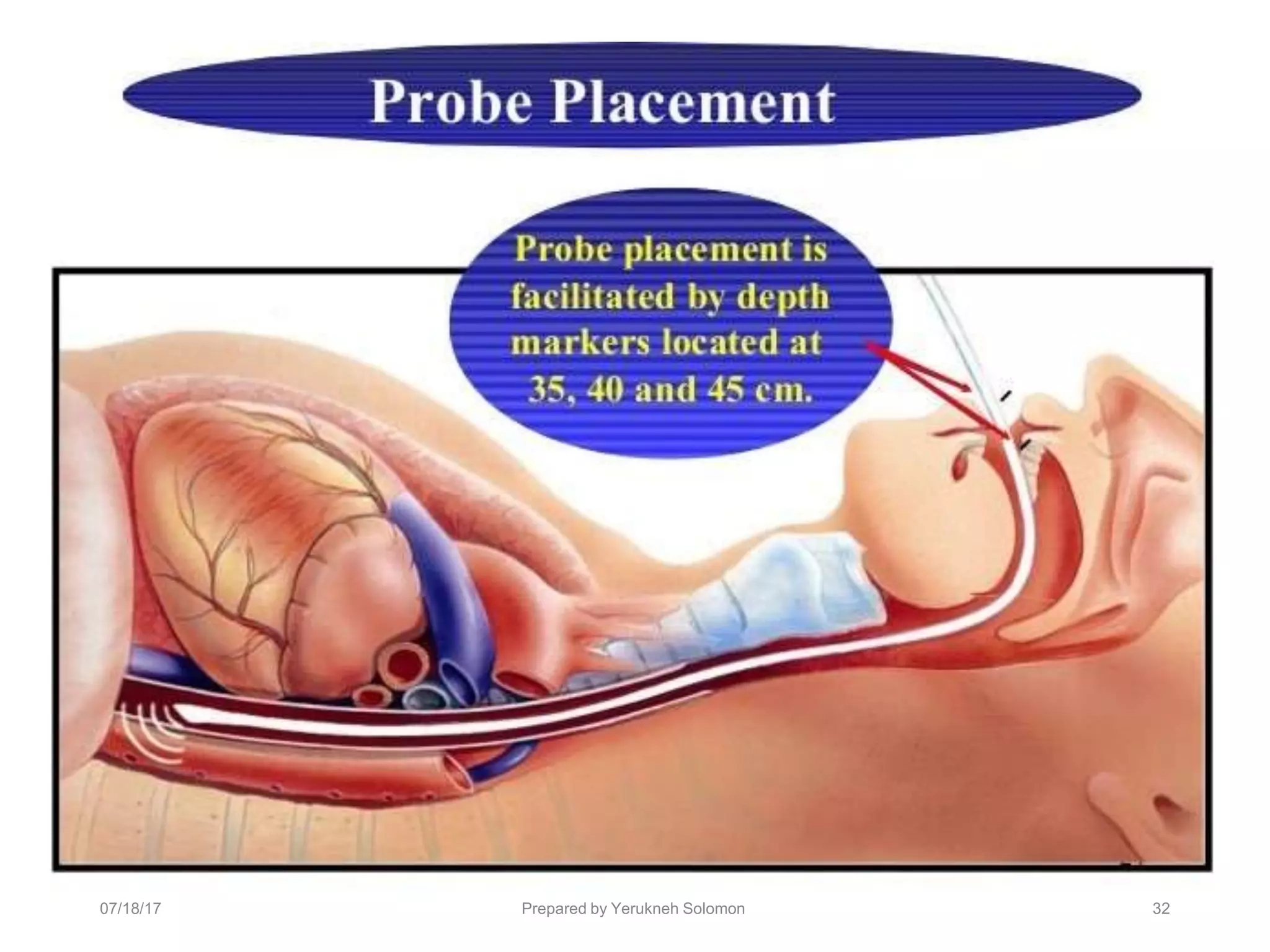 07/18/17 Prepared by Yerukneh Solomon 32
 