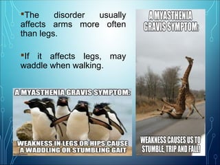 The disorder usually
affects arms more often
than legs.
If it affects legs, may
waddle when walking.
 