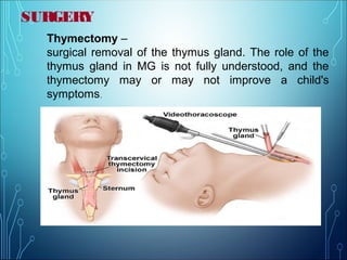 SURGERY
Thymectomy –
surgical removal of the thymus gland. The role of the
thymus gland in MG is not fully understood, and the
thymectomy may or may not improve a child's
symptoms.
 