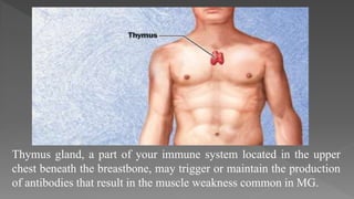 Thymus gland, a part of your immune system located in the upper
chest beneath the breastbone, may trigger or maintain the production
of antibodies that result in the muscle weakness common in MG.
 