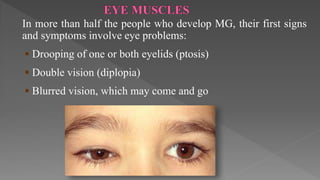 In more than half the people who develop MG, their first signs
and symptoms involve eye problems:
 Drooping of one or both eyelids (ptosis)
 Double vision (diplopia)
 Blurred vision, which may come and go
 