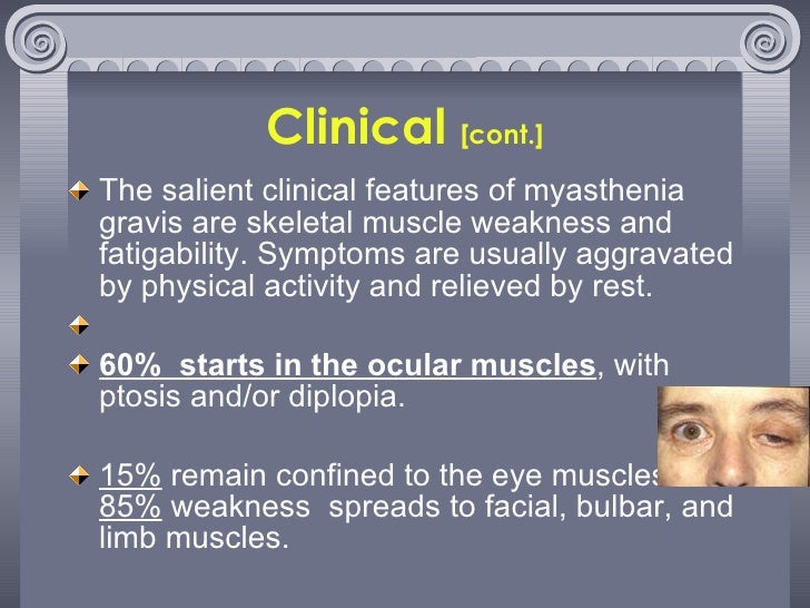 Myasthenia gravis