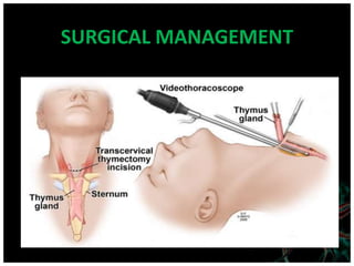 SURGICAL MANAGEMENT
 