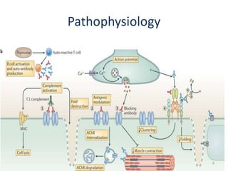 Pathophysiology
9
 