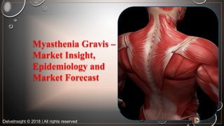 DelveInsight © 2018 | All rights reserved
Myasthenia Gravis –
Market Insight,
Epidemiology and
Market Forecast
 