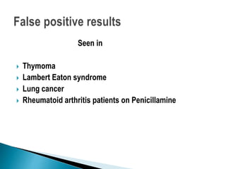 Seen in
 Thymoma
 Lambert Eaton syndrome
 Lung cancer
 Rheumatoid arthritis patients on Penicillamine
 