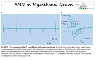 EMG in Myasthenia Gravis
 