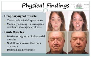 Oropharyngeal muscle
 Characteristic facial appearance
 Manually opening the jaw against
resistance shows jaw weakness
 Limb Muscles
 Weakness begins in Limb or Axial
muscles
 Neck flexors weaker than neck
extensors
 Dropped head syndrome
Physical Findings
 