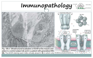 Immunopathology
 