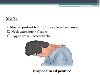 SIGNS
• Most important feature is peripheral weakness.
Neck extensors > flexors
Upper limbs > lower limbs
Dropped head posture
 
