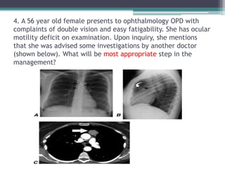 4. A 56 year old female presents to ophthalmology OPD with
complaints of double vision and easy fatigability. She has ocular
motility deficit on examination. Upon inquiry, she mentions
that she was advised some investigations by another doctor
(shown below). What will be most appropriate step in the
management?
 