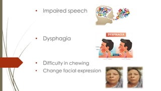 • Impaired speech
• Dysphagia
• Difficulty in chewing
• Change facial expression
 
