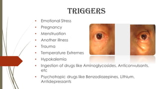 triggers
• Emotional Stress
• Pregnancy
• Menstruation
• Another illness
• Trauma
• Temperature Extremes
• Hypokalemia
• Ingestion of drugs like Aminoglycosides, Anticonvulsants,
etc
• Psychotropic drugs like Benzodiazepines, Lithium,
Antidepressants
 