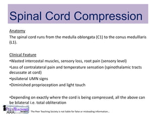 myasthenia_gravis_carpal_tunnel_gbs_mnd_cord_compression_ms_stroke.ppt