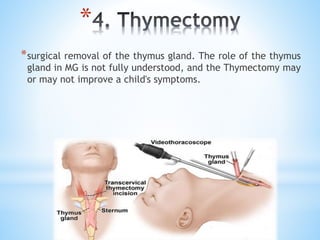 *
*surgical removal of the thymus gland. The role of the thymus
gland in MG is not fully understood, and the Thymectomy may
or may not improve a child's symptoms.
 