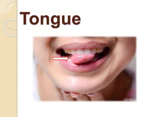 Tongue
 