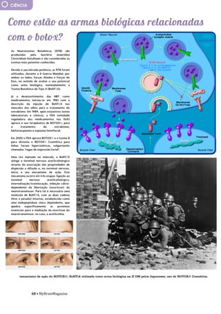 68 • MyBrainMagazine
CIÊNCIA
As Neurotoxinas Botulínicas (NTB) são
produzidas pela bactéria anaeróbia
Clostridium botulinum e são consideradas as
toxinas mais potentes conhecidas.
Devido à sua elevada potência, as NTB foram
utilizadas, durante a II Guerra Mundial, por
ambos os lados, Forças Aliadas e Forças do
Eixo, no sentido de avaliar o seu potencial
como arma biológica, nomeadamente a
Toxina Botulínica do Tipo A (BoNT/A).
Já o desenvolvimento das NBT como
medicamentos iniciou-se em 1981 com a
descrição da injeção de BoNT/A nos
músculos dos olhos para o tratamento do
estrabismo. Em 1989, após exaustivos testes
laboratoriais e clínicos, a FDA (entidade
reguladora dos medicamentos nos EUA)
aprova o uso terapêutico de BOTOX®, para
o tratamento do estrabismo,
blefaroespasmo e espasmo hemifacial.
Em 2000 o FDA aprova BOTOX® e a toxina B
para distonia e BOTOX® Cosmética para
linhas faciais hipercinéticas, vulgarmente
chamadas "rugas de expressão facial".
Uma vez injetada no músculo, a BoNT/A
atinge o terminal nervoso acetilcolinérgico
através da associação das propriedades de
dispersão e difusão e, no terminal nervoso,
inicia o seu mecanismo de ação. Este
mecanismo ocorre em três etapas: ligação ao
terminal nervoso acetilcolinérgico,
internalização/translocação, inibição cálcio-
dependente da libertação (exocitose) do
neurotransmissor. Para tal é necessária uma
molécula de BoNT/A, com as duas cadeias
(leve e pesada) intactas, estabelecida como
uma endopeptidase zinco dependente, que
quebra especificamente as proteínas
essenciais para a mediação da exocitose do
neurotransmissor, no caso, a acetilcolina.
.de uso ampliado; descartáveis; coloridas ou
cosméticas; de proteção ultravioleta (UV);
que refazem a forma da córnea (estas lentes
são usadas durante a noite e refazem
gradualmente a forma da córnea para
corrigir a visão. Quando as tiramos,
podemos ver com clareza temporariamente
sem lentes de contacto.
As lentes rígidas e permeáveis ao
gás, que foram desenvolvidas no final dos
anos 70, são feitas de uma combinação de
PMMA, silicone e fluoropolímeros (um tipo
de plástico poroso). Estas lentes combinam
algumas das características de lentes de
contacto rígidas e flexíveis. São mais
duráveis que as lentes flexíveis, mas ainda
permitem que o oxigénio passe para o olho,
tornando-as mais confortáveis de usar do
que as lentes rígidas. Como elas não contêm
água, têm menor probabilidade de
desenvolver bactérias e provocar infecções
do que as lentes flexíveis. A rigidez das
lentes fornece uma visão mais clara e mais
nítida.
mecanismo de ação do BOTOX®; BoNT/A utilizada como arma biológica na II GM pelos Japoneses; uso de BOTOX® Cosmética.
 