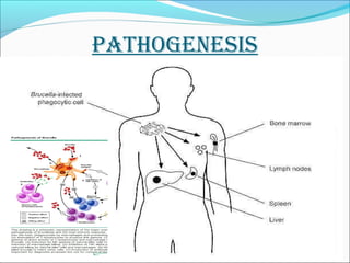 PATHOGENESIS 
 