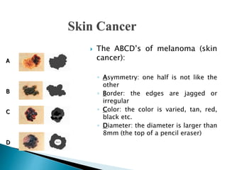  The ABCD’s of melanoma (skin
cancer):
◦ Asymmetry: one half is not like the
other
◦ Border: the edges are jagged or
irregular
◦ Color: the color is varied, tan, red,
black etc.
◦ Diameter: the diameter is larger than
8mm (the top of a pencil eraser)
A
B
C
D
 