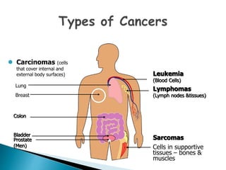  Carcinomas (cells
that cover internal and
external body surfaces)
Lung
Breast
Colon
Bladder
Prostate
(Men)
Leukemia
(Blood Cells)
Lymphomas
(Lymph nodes &tissues)
Sarcomas
Cells in supportive
tissues – bones &
muscles
 