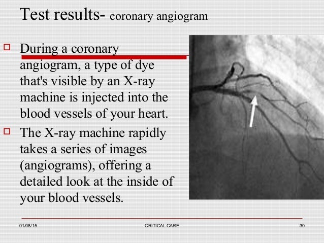 using heart test dye Mycardial infaction