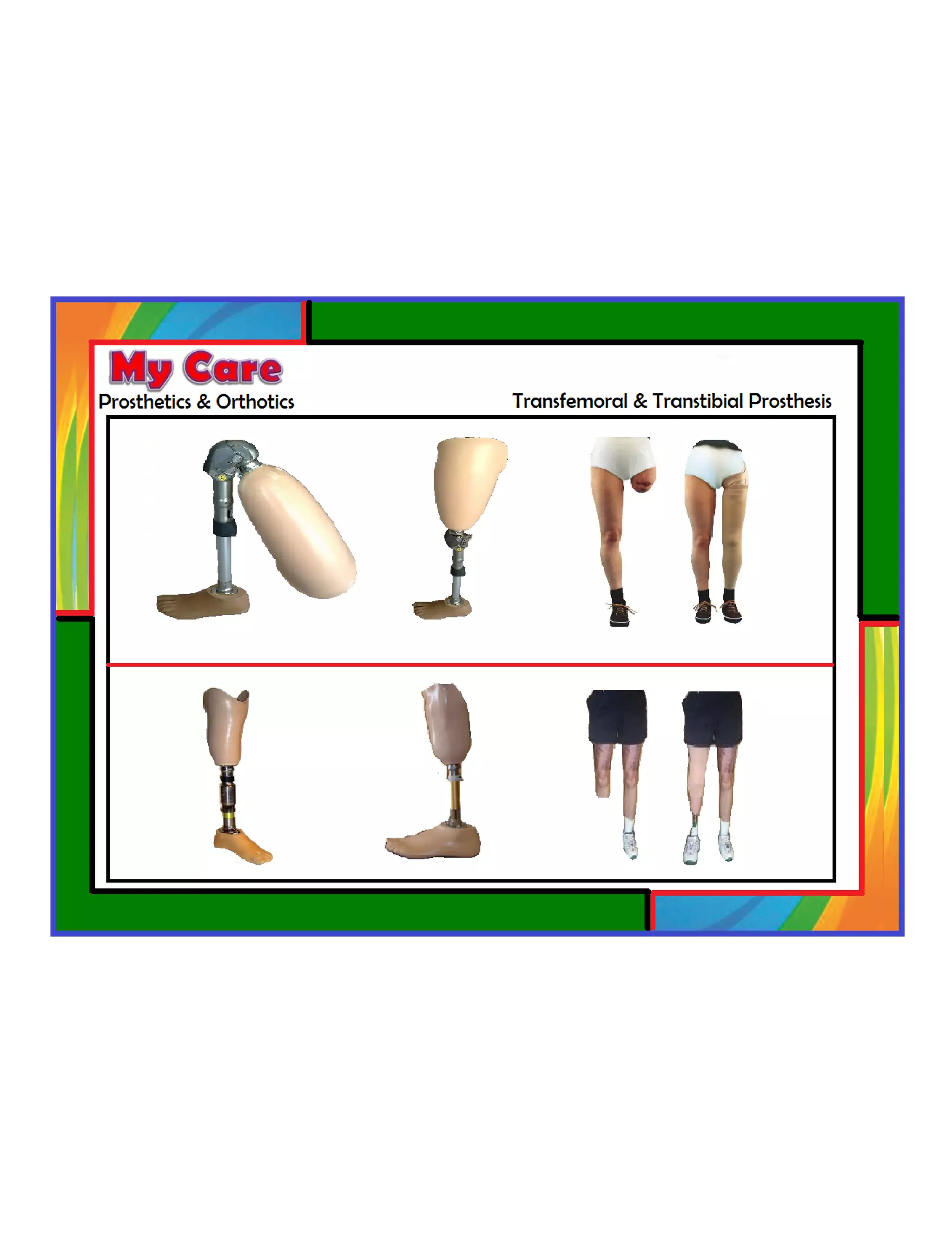 Customs Orthotics and Prosthetics PDF Death, Injury, or Military