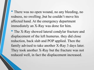 • There was no open wound, no any bleeding, no
redness, no swelling ,but he couldn’t move his
affected hand. At the emergency department
immediately an X-Ray was done for him.
• The X-Ray showed lateral condylar fracture and
displacement of the left humerus. they did close
reduction, back slab and POP applied. Then the
family advised to take another X-Ray 3 days later.
They took another X-Ray but the fracture was not
reduced well, in fact the displacement increased.
 