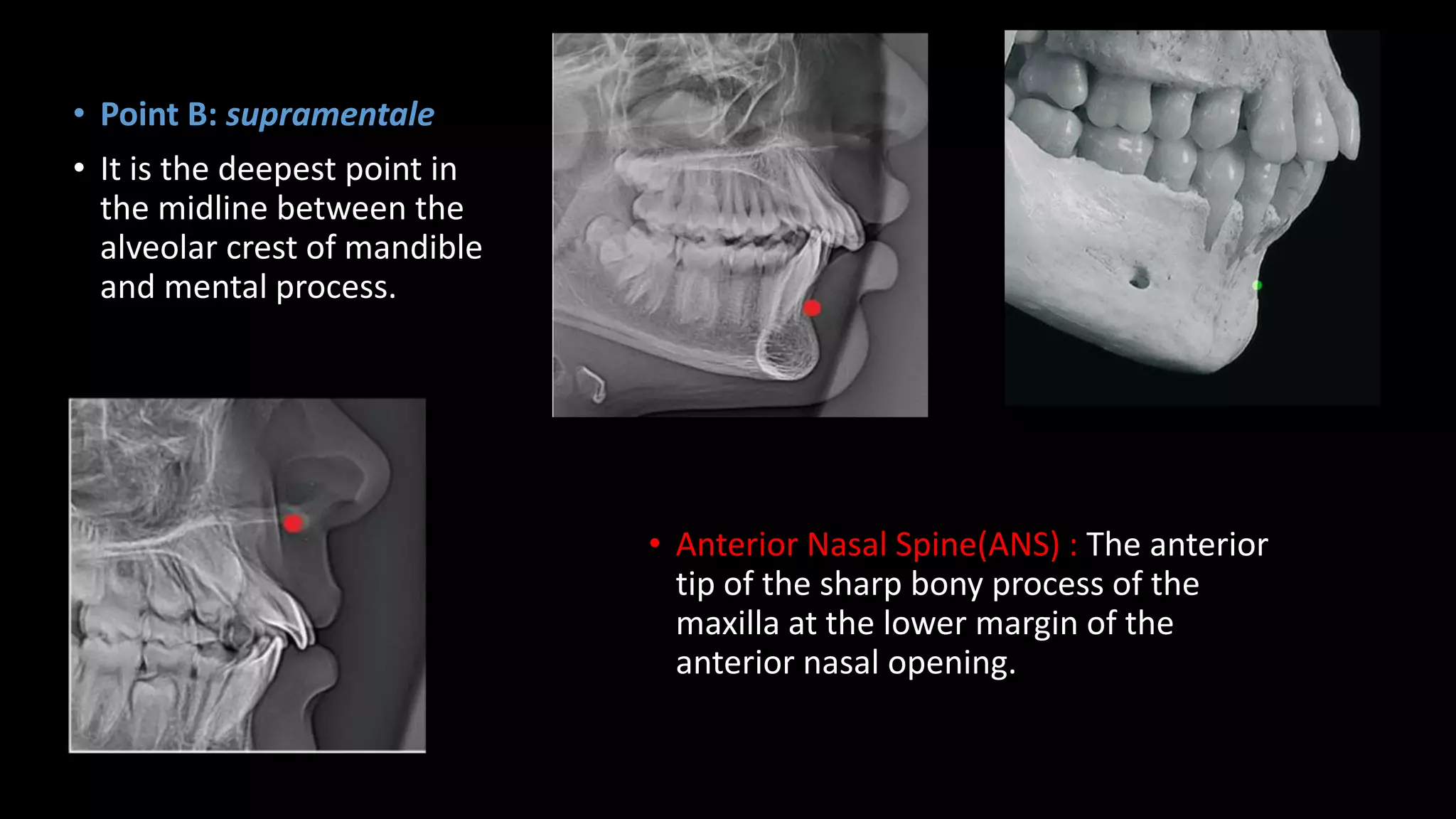 CEPHELOMETRICS IN PEDIATRIC DENTISTRY | PPTX