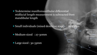  Todetermine maxillomandibular differential
midfacial length measurement is subtracted from
mandibular length
 Small individuals (mixed dentition stage) : 20-23mm
 Medium-sized : 27-30mm
 Large sized : 30-33mm
 