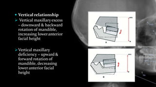  Vertical relationship
 Vertical maxillaryexcess
– downward & backward
rotation of mandible,
increasing loweranterior
facial height
Vertical maxillary
deficiency – upward &
forward rotation of
mandible, decreasing
lower anterior facial
height
 