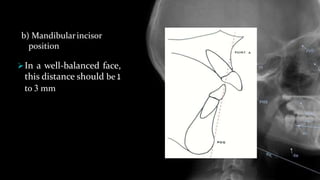 b) Mandibularincisor
position
In a well-balanced face,
this distance should be 1
to 3 mm
 