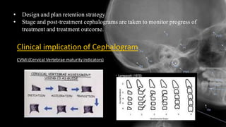 • Design and plan retention strategy
• Stage and post-treatment cephalograms are taken to monitor progress of
treatment and treatment outcome.
Clinical implication of Cephalogram
CVMI (Cervical Vertebrae maturity indicators)
 
