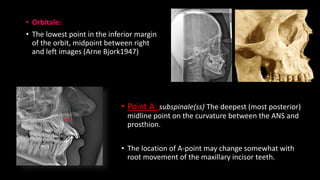 • Orbitale:
• The lowest point in the inferior margin
of the orbit, midpoint between right
and left images (Arne Bjork1947)
• Point A: subspinale(ss) The deepest (most posterior)
midline point on the curvature between the ANS and
prosthion.
• The location of A-point may change somewhat with
root movement of the maxillary incisor teeth.
 