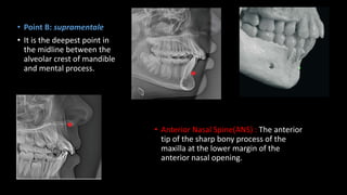 • Point B: supramentale
• It is the deepest point in
the midline between the
alveolar crest of mandible
and mental process.
• Anterior Nasal Spine(ANS) : The anterior
tip of the sharp bony process of the
maxilla at the lower margin of the
anterior nasal opening.
 