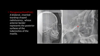 • Pterygomaxillare(Ptm) :
A bilateral , inverted
teardrop shaped
radiolucency , whose
anterior border
represents the posterior
surfaces of the
tuberosities of the
maxilla.
 