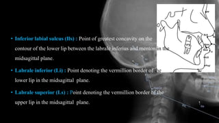 • Inferior labial sulcus (Ils) : Point of greatest concavity on the
contour of the lower lip between the labrale inferius and menton in the
midsagittal plane.
• Labrale inferior (Li) : Point denoting the vermillion border of the
lower lip in the midsagittal plane.
• Labrale superior (Ls) : Point denoting the vermillion border of the
upper lip in the midsagittal plane.
 