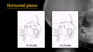 Horizontal planes
FH PLANE S N PLANE
 