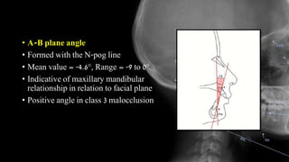 • A-B plane angle
• Formed with the N-pog line
• Mean value = -4.6°, Range = -9 to 0°
• Indicative of maxillary mandibular
relationship in relation to facial plane
• Positive angle in class 3 malocclusion
 