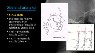 Skeletal analysis
• S.N.A angle
• Indicates the relative
antero-posterior
positioning of maxilla in
relation to cranial base
• >82° -- prognathic
maxilla (Class 2)
• < 82°– retrognathic
maxilla (class 3)
 