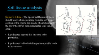 Soft tissue analysis
Steiner’s S-Line : The lips in well balanced faces
should touch a line extending from the soft tissue
contour of the chin to the middle of an S formed by
the lower border of the nose referred to as the S-
Line.
• Lips located beyond this line tend to be
protrusive.
• Lips located behind this line patients profile tends
to be concave.
 