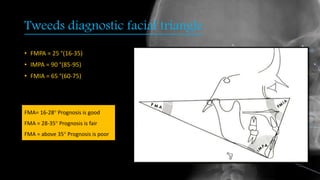 Tweeds diagnostic facial triangle
• FMPA = 25 °(16-35)
• IMPA = 90 °(85-95)
• FMIA = 65 °(60-75)
FMA= 16-28° Prognosis is good
FMA = 28-35° Prognosis is fair
FMA = above 35° Prognosis is poor
 