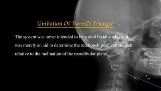 Limitation Of Tweed’s Triangle
The system was never intended to be a total facial analysis, it
was merely an aid to determine the relationships of certain teeth
relative to the inclination of the mandibular plane
 