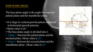 BASE PLANE ANGLE:
The base plane angle is the angle between the
palatal plane and the mandibular plane.
• It is large in vertical growth pattern and small
in horizontal growth patterns.
• Mean value is 25° .
• The base plane angle is divided into 2:
• Upper – between the palatal plane and the
occlusal plane. Mean value is 11°.
• lower – between the occusal plane and the
mandibular plane . Mean value is 14°.
 